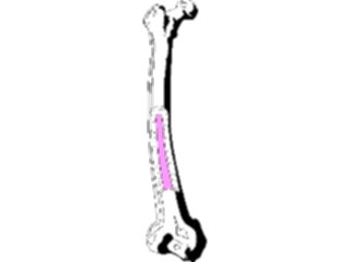 Sticker Custom Preview Image #014663 Anatomy Femur