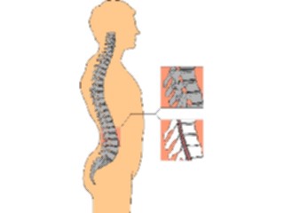 Sticker Custom Preview Image #014838 Anatomy Spinal Column