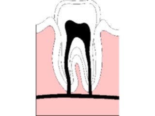 Sticker Custom Preview Image #068667 Health Medical Dental Tooth Root